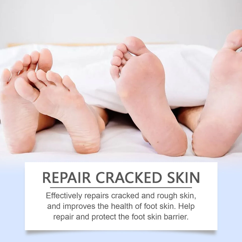 Moisturizing And Smooth Nourishing Not Oily Mild Foot Chapped Care