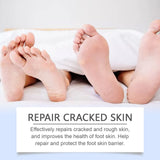 Moisturizing And Smooth Nourishing Not Oily Mild Foot Chapped Care